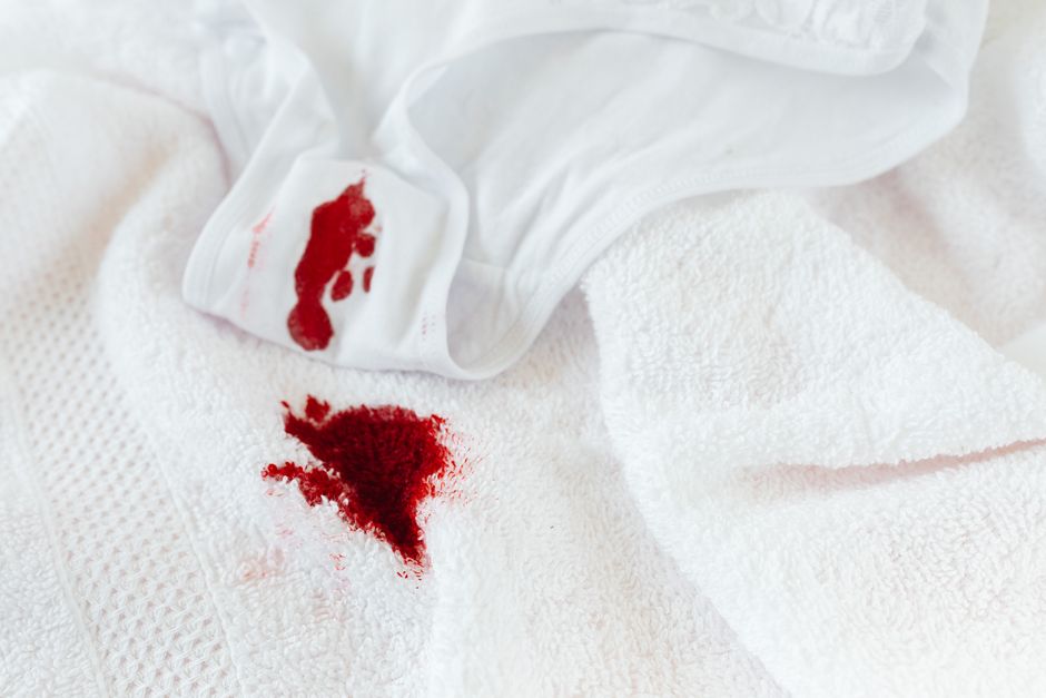 Targeted stain removal on a light colored carpet
